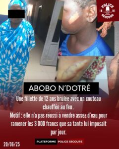 abobo-ndotre-fillette-de-12-ans-brulee-sa-tante